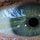 The Reflection in My Eye